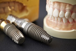 Dental implants in McKinney resting on table with dentures