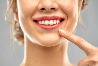 woman pointing to her straight white smile