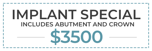 Implant special Only $3500