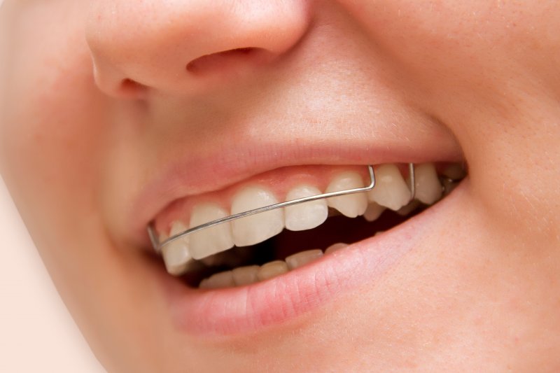 Close-up of a young girl wearing a retainer